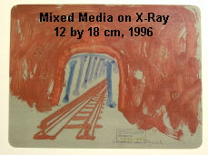 Mixed Media on X-Ray 102