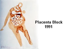 Placenta Block